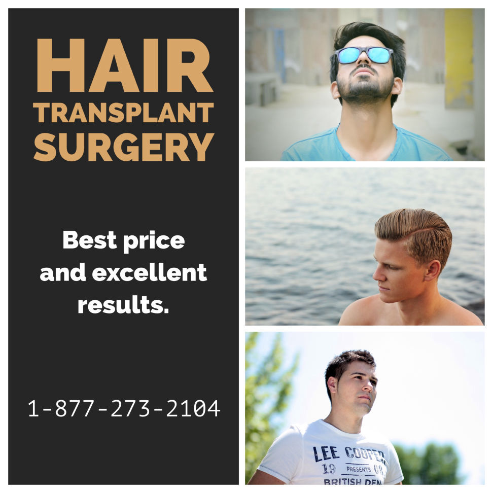 hair transplant surgery